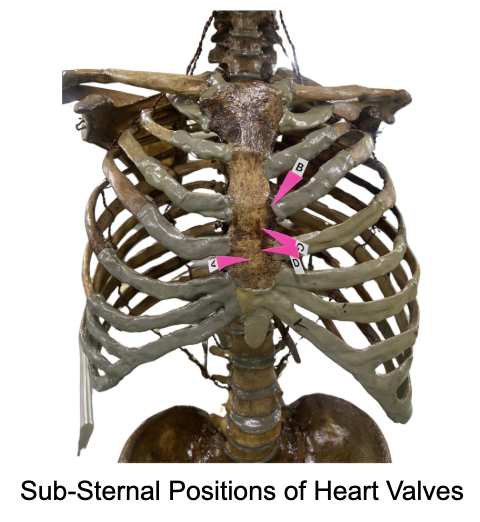 <p>Where is the most probable location of: <span>Mitral Valve&nbsp;</span></p>