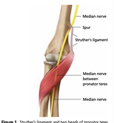<p>Ligament of Struthers is only present in 1% of population (Genetic). Testing will show all median nerve issues, includes sxs reproduced w/</p>