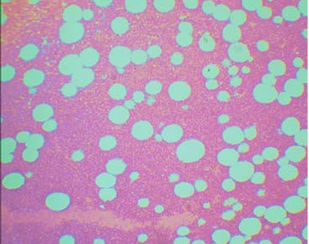 <p>What are the white circles?</p>