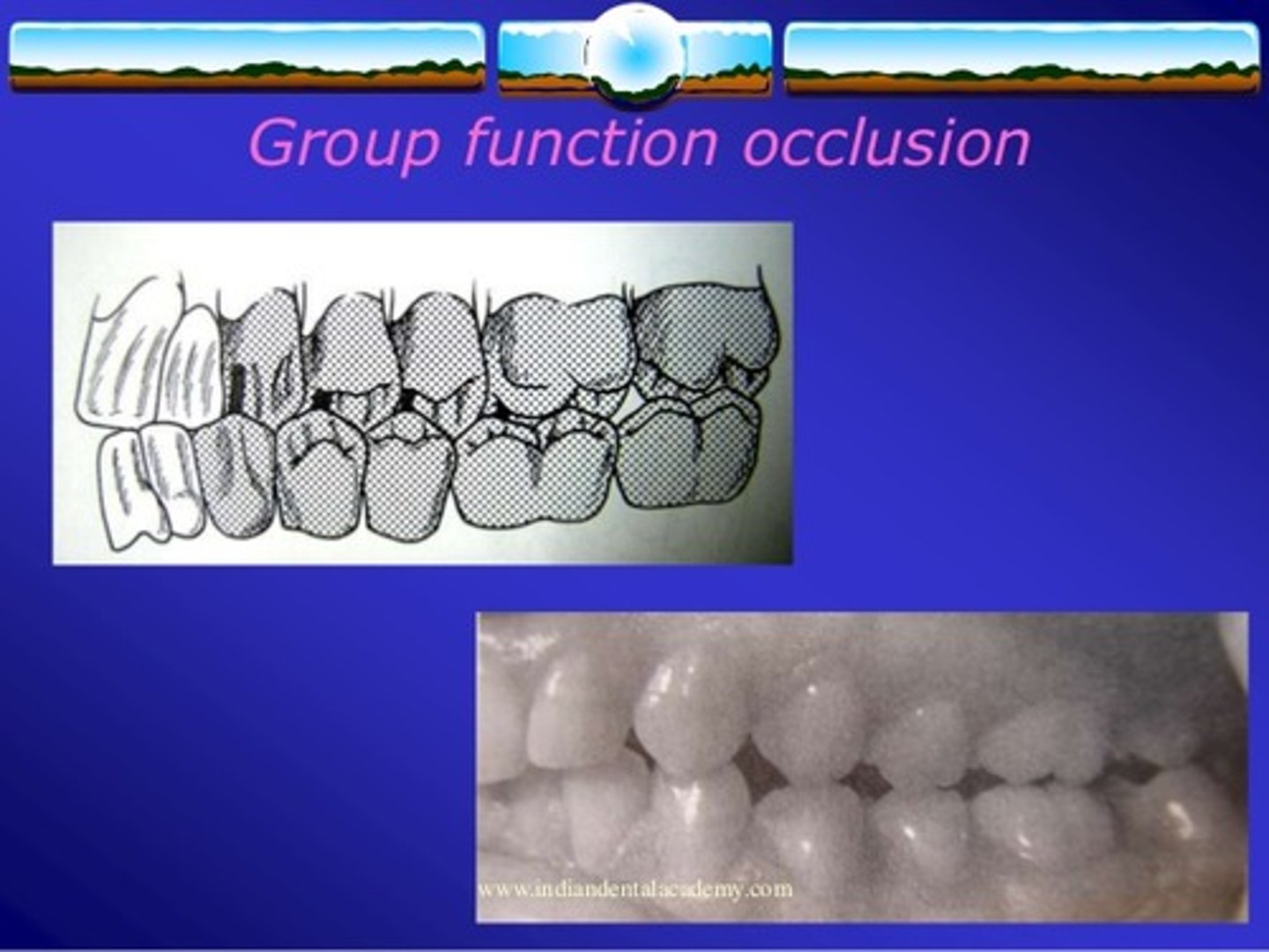 <p>multiple tooth contacts between the maxilla and mandible in lateral jaw movements</p>
