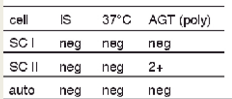 <p>antibody screen results + possible interpretations:</p><ul><li><p>2+ only at AHG phase with SCII</p></li></ul><p></p>