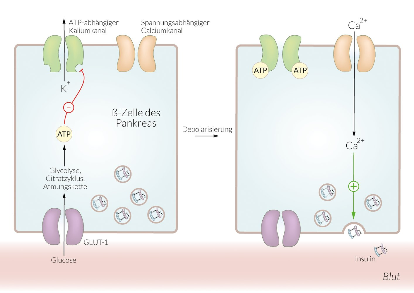 <p>B. Inhibition of ATP-sensitive K⁺ channels</p>