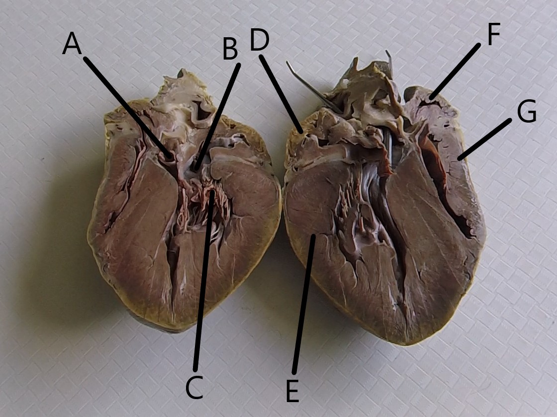 <p>What is D?</p>