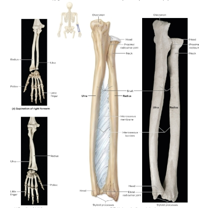 <p>Ulna</p>