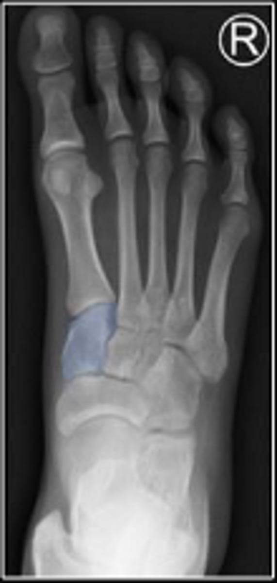 <p>What is outlined?</p>