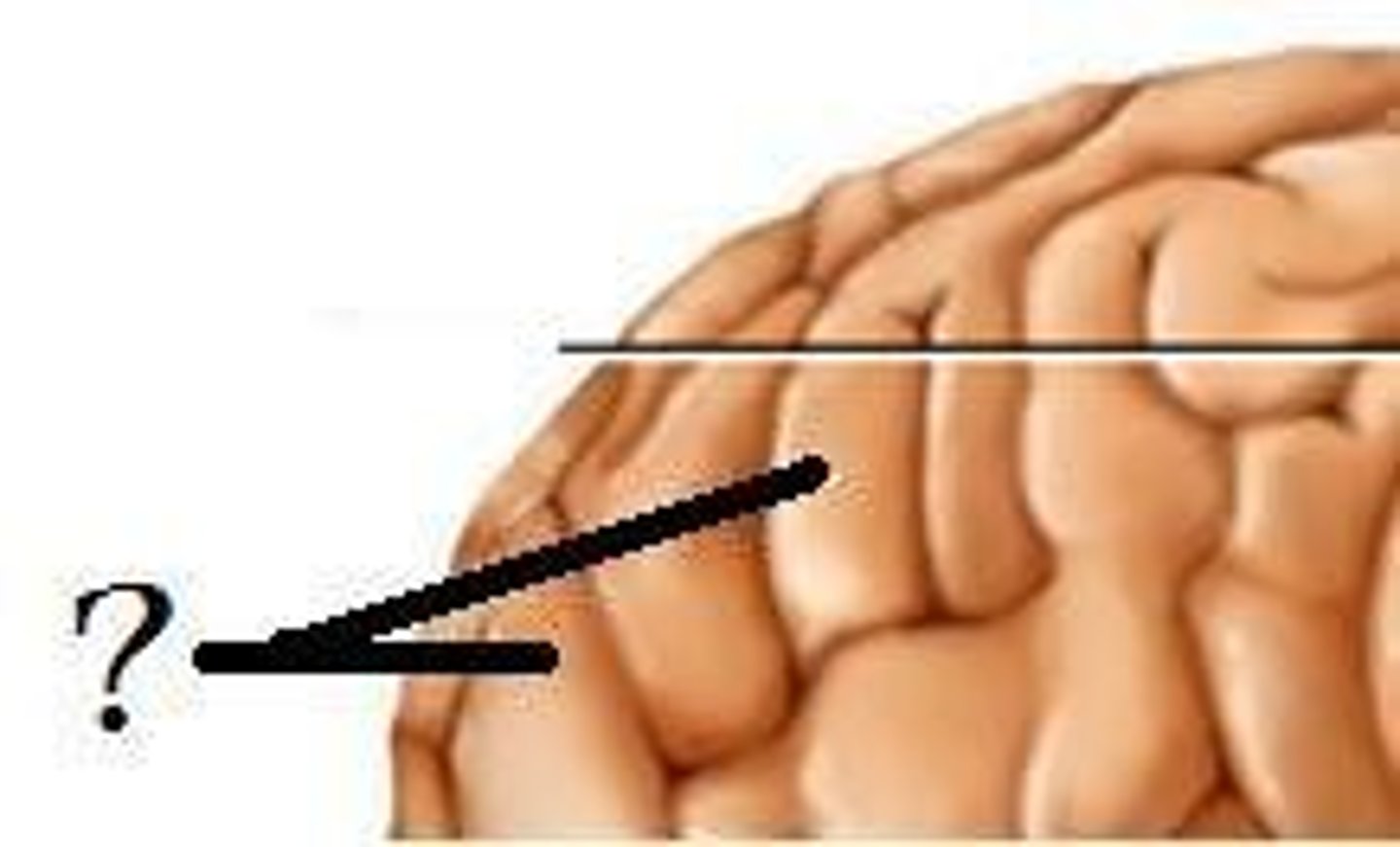 <p>Ridges (convolutions) on the surface of the brain</p>