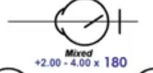 <p>mixed astigmatism </p>