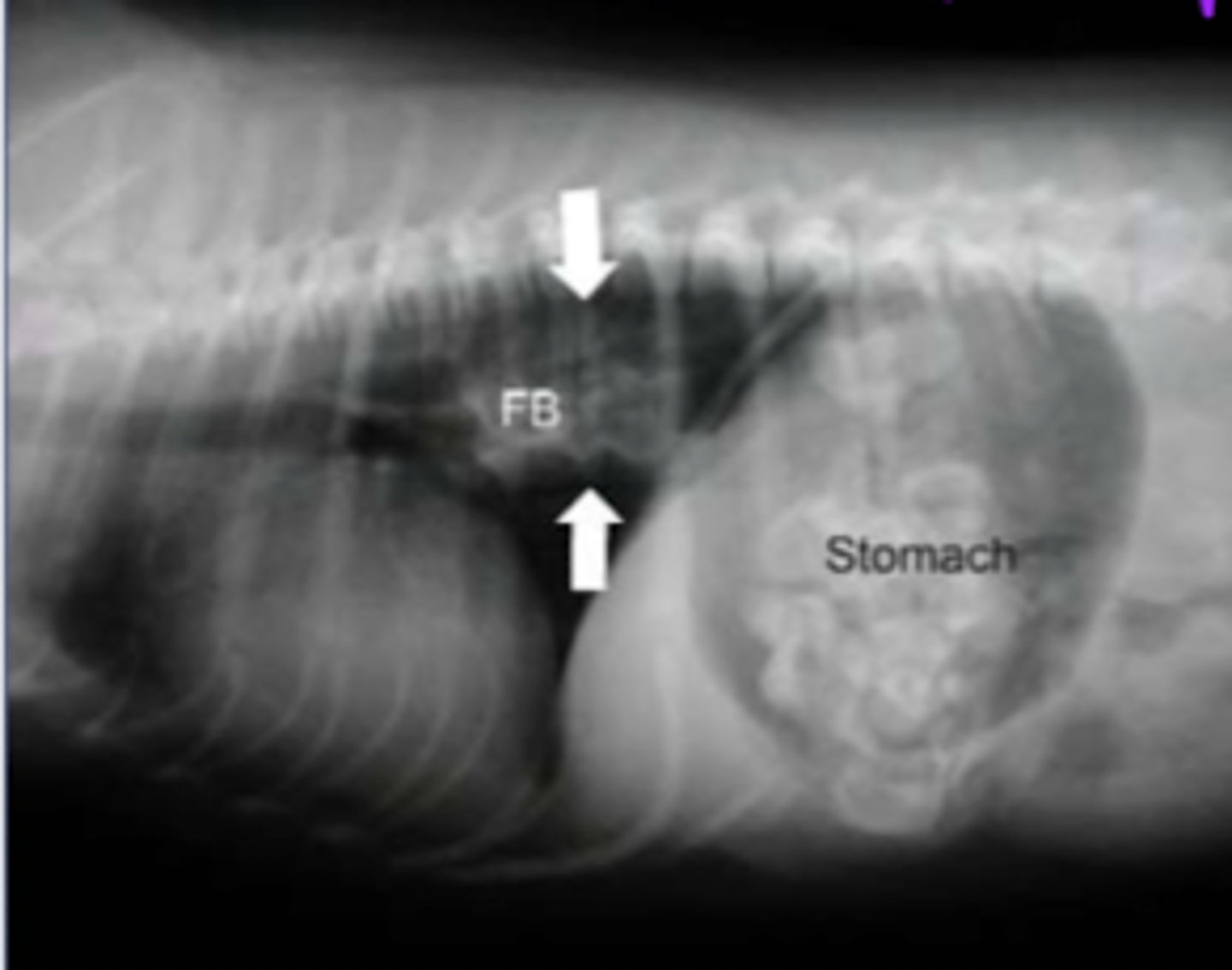 <p>what is the disorder we see here?</p>