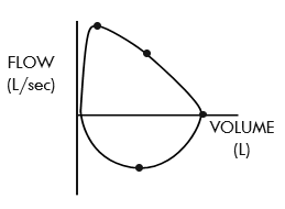 <p>what are the two important things that can be pointed out on a flow-volume loop </p>