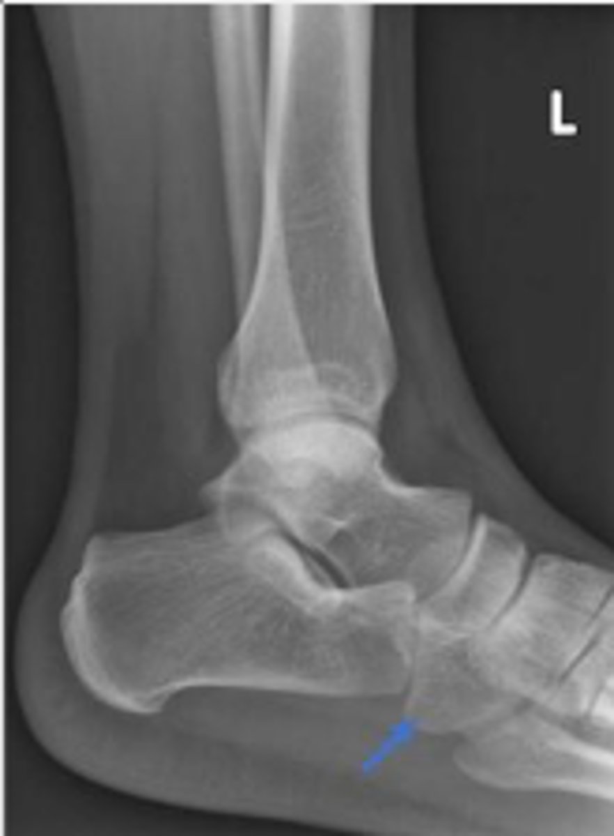 <p>What is the arrow pointing to?</p>