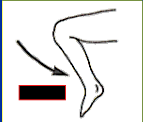 <p>What Movement is occurring?</p>