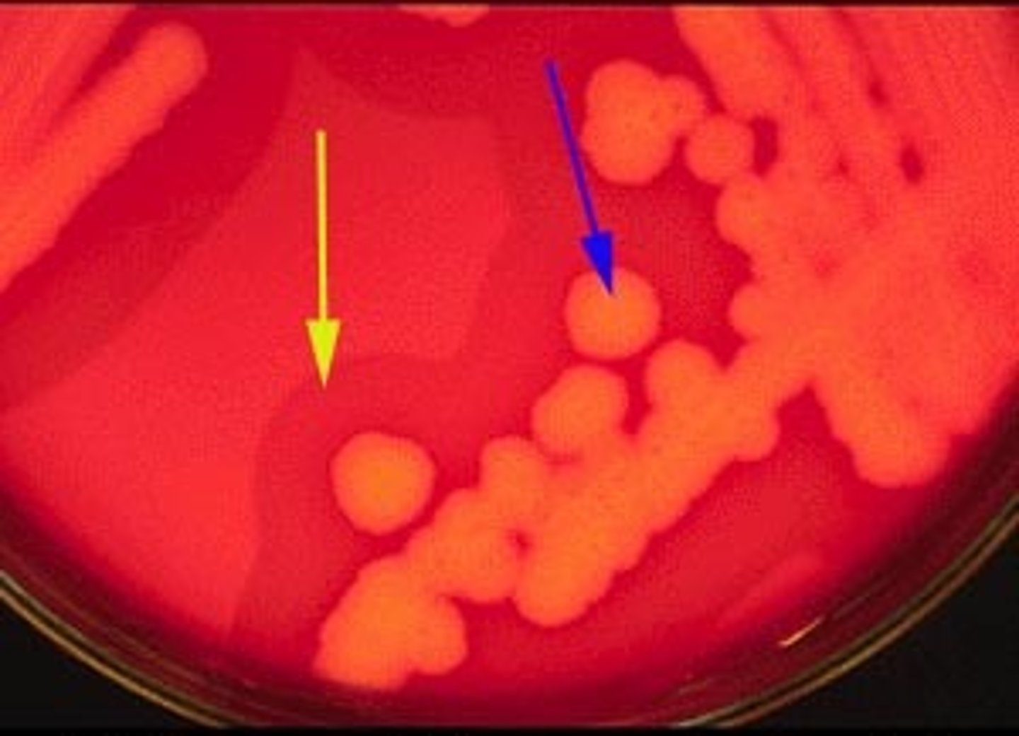 <p><strong>How Can Microbes Become Resistant?</strong></p><p></p><p>Some bacteria can inactivate the central rings of penicillins with which enzyme?</p>