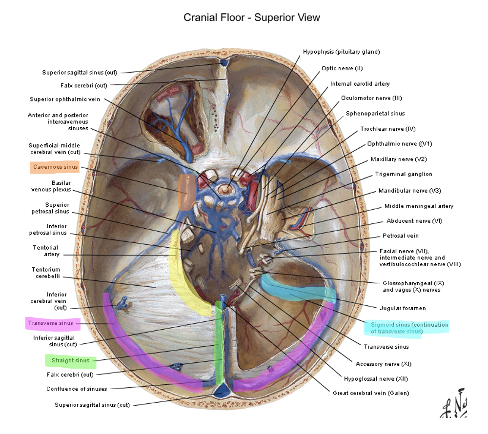 <p>cavernous </p>
