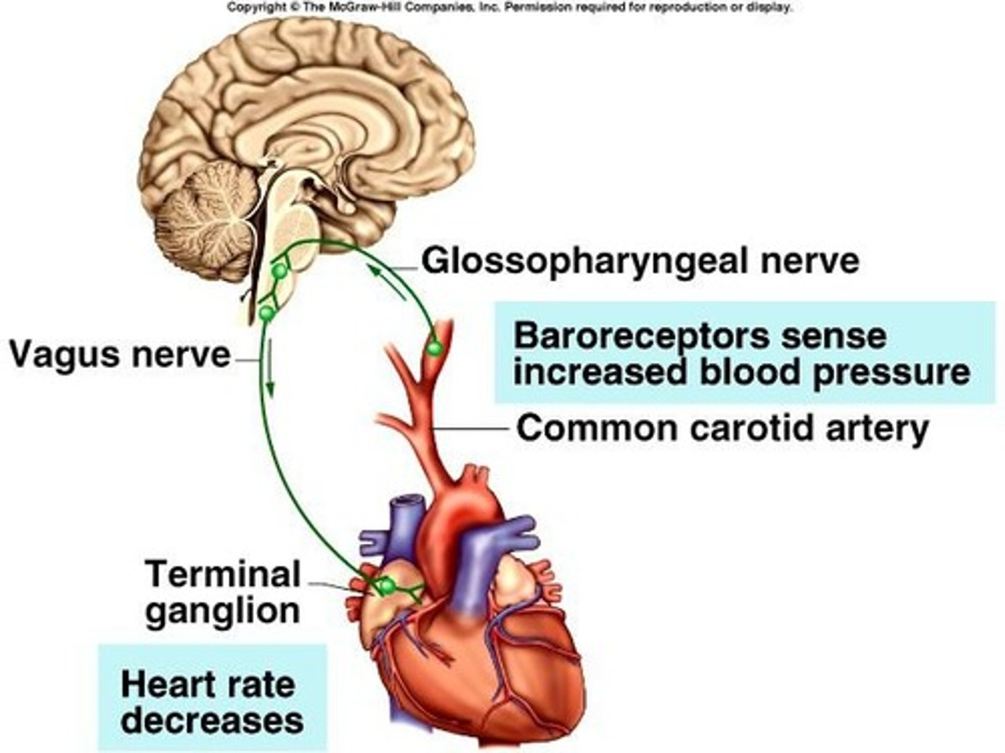 <p>High BP is detected by arterial stretch receptors, signals are sent to the CNS, and efferent signals slow the heart to reduce BP.</p>