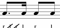 <p>What Variation is This? </p>