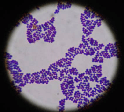 <p>A clump of spherical shaped cells</p>