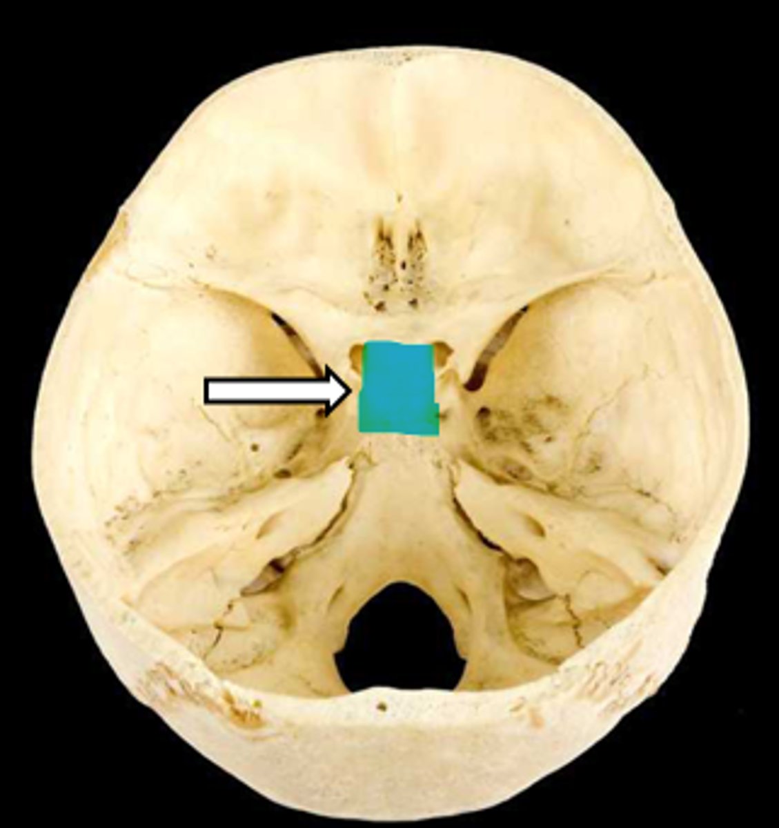 <p>name the part</p>