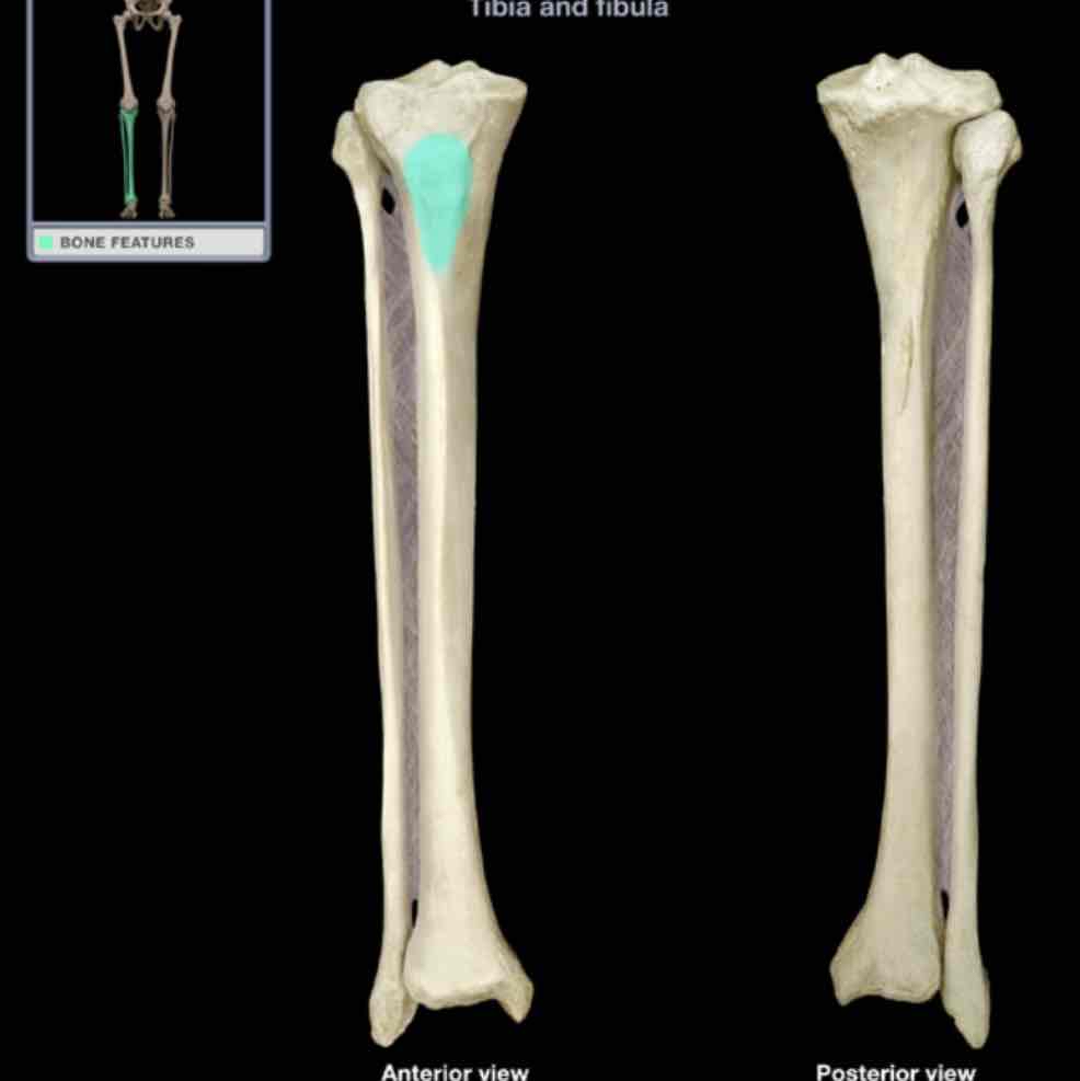 <p>Tibial tuberosity</p>