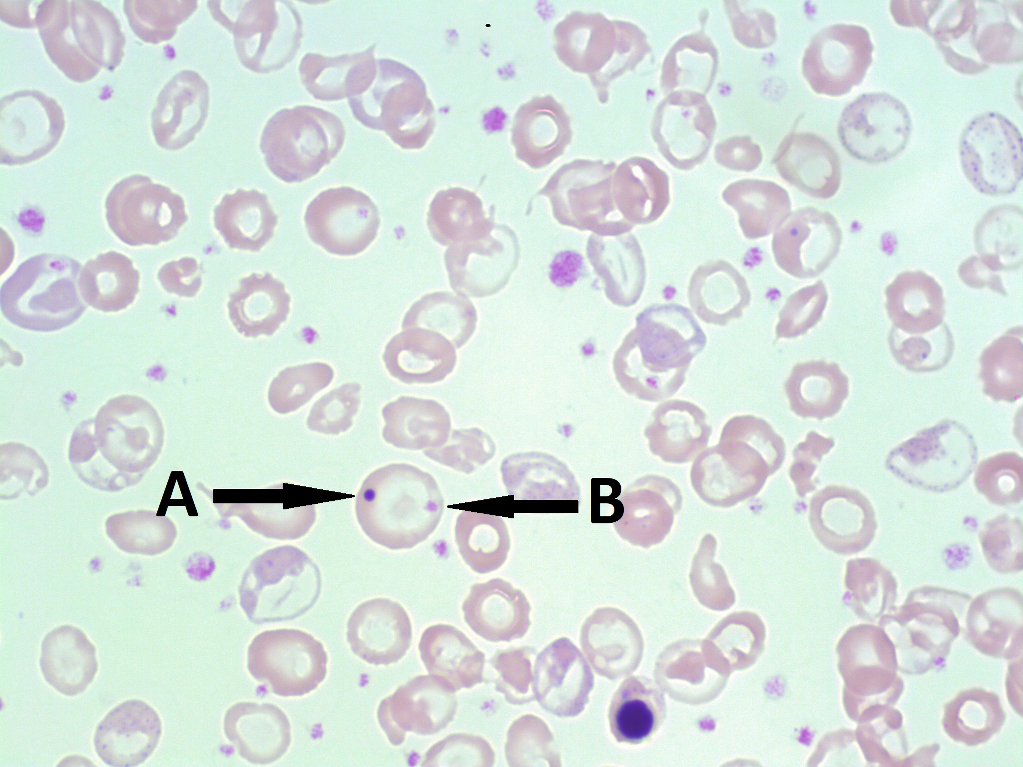 <p>What is the arrow pointing to?</p>