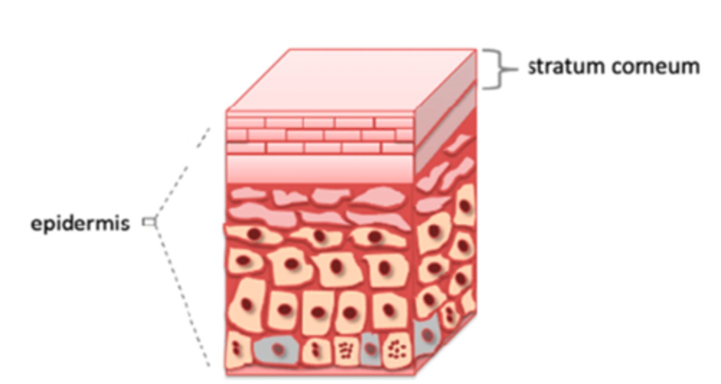 <p>Horny layer</p><p>Thick layer of dead keratinocytes</p><p>Protects against abrasion and penetration</p>