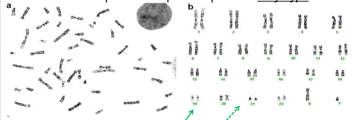 <p>Karyotype</p>