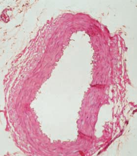 <p>What histological slide is this for?</p>