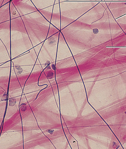 <p>What tissue type does this image depict?</p>