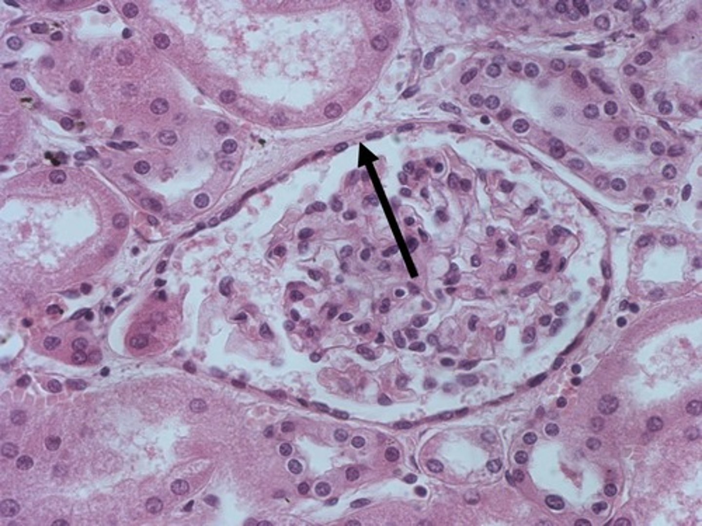 <p>single layer of flattened cells</p>