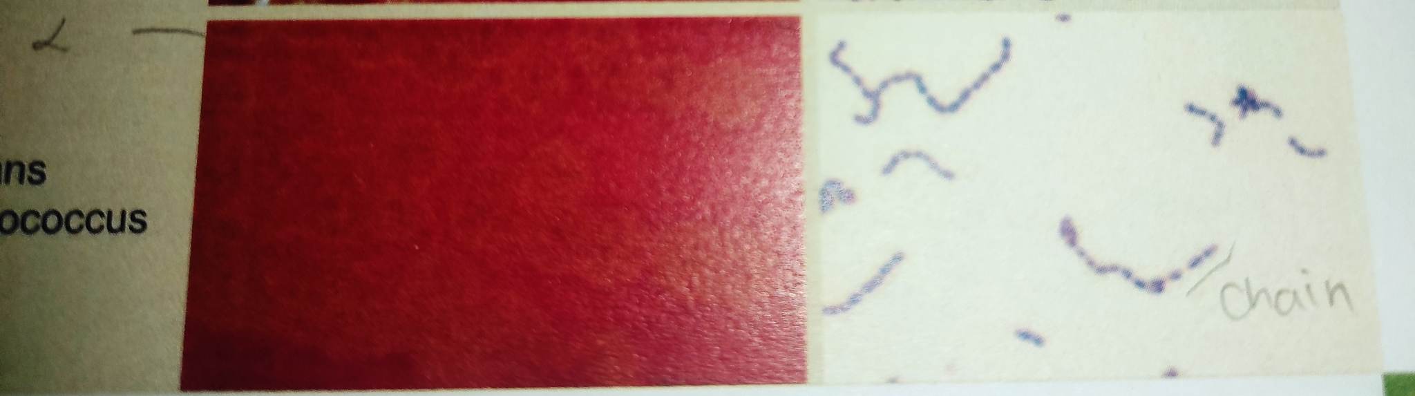 **Macroscopic examination** 

**Colonies:**

\
* minute to small, gray, domed, smooth or matte; alpha-hemolytic or nonhemolytic