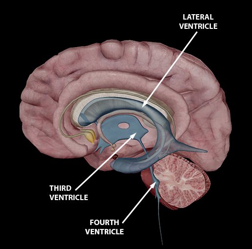 <p>Lateral ventricle </p>