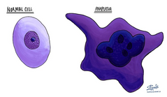 <p>Anaplasia</p>