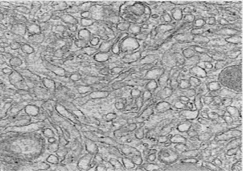 <p>What part of the cell is this? What is its function?</p>