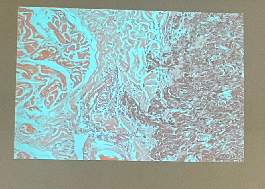 term image