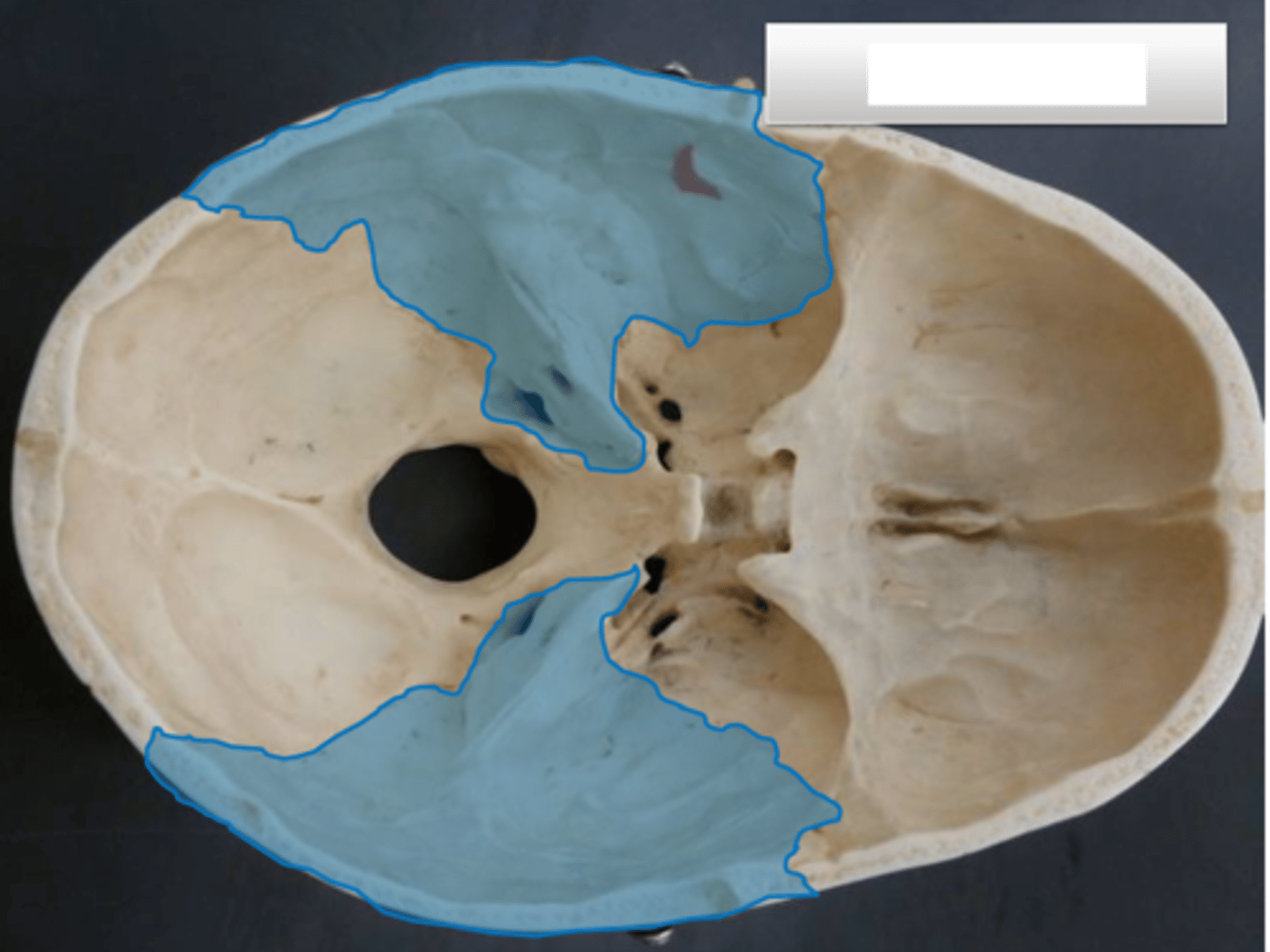 <p>blue highlighted</p>