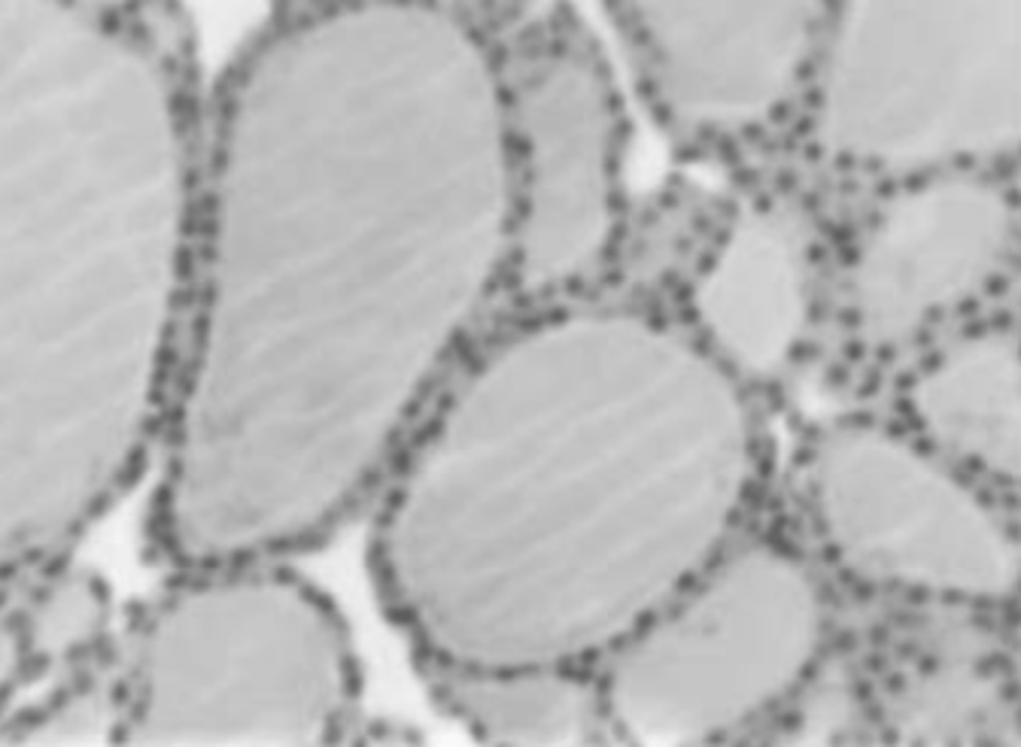 <p>What gland do we observe in the following histological section?</p><p>a) Prostate.</p><p>b) Thyroid.</p><p>c) Parathyroid.</p><p>d) Mammary gland.</p>