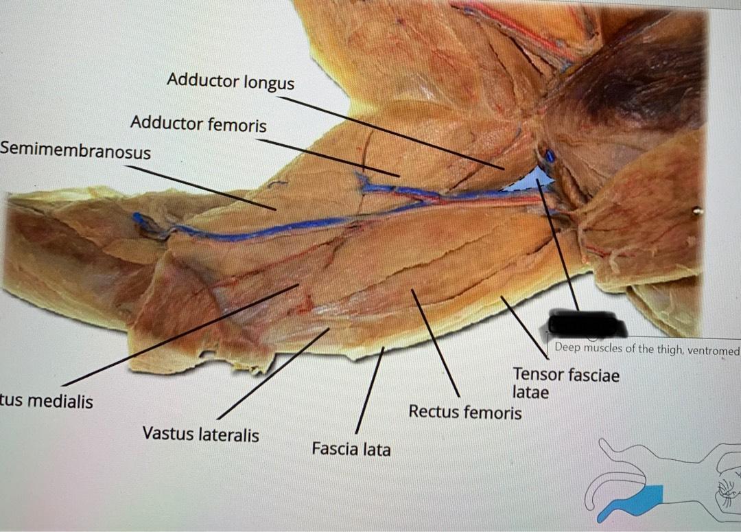 <p>Origin: Medial Surface of femur</p><p>Insertion: Tibial crest</p><p>Action: Extends leg</p>