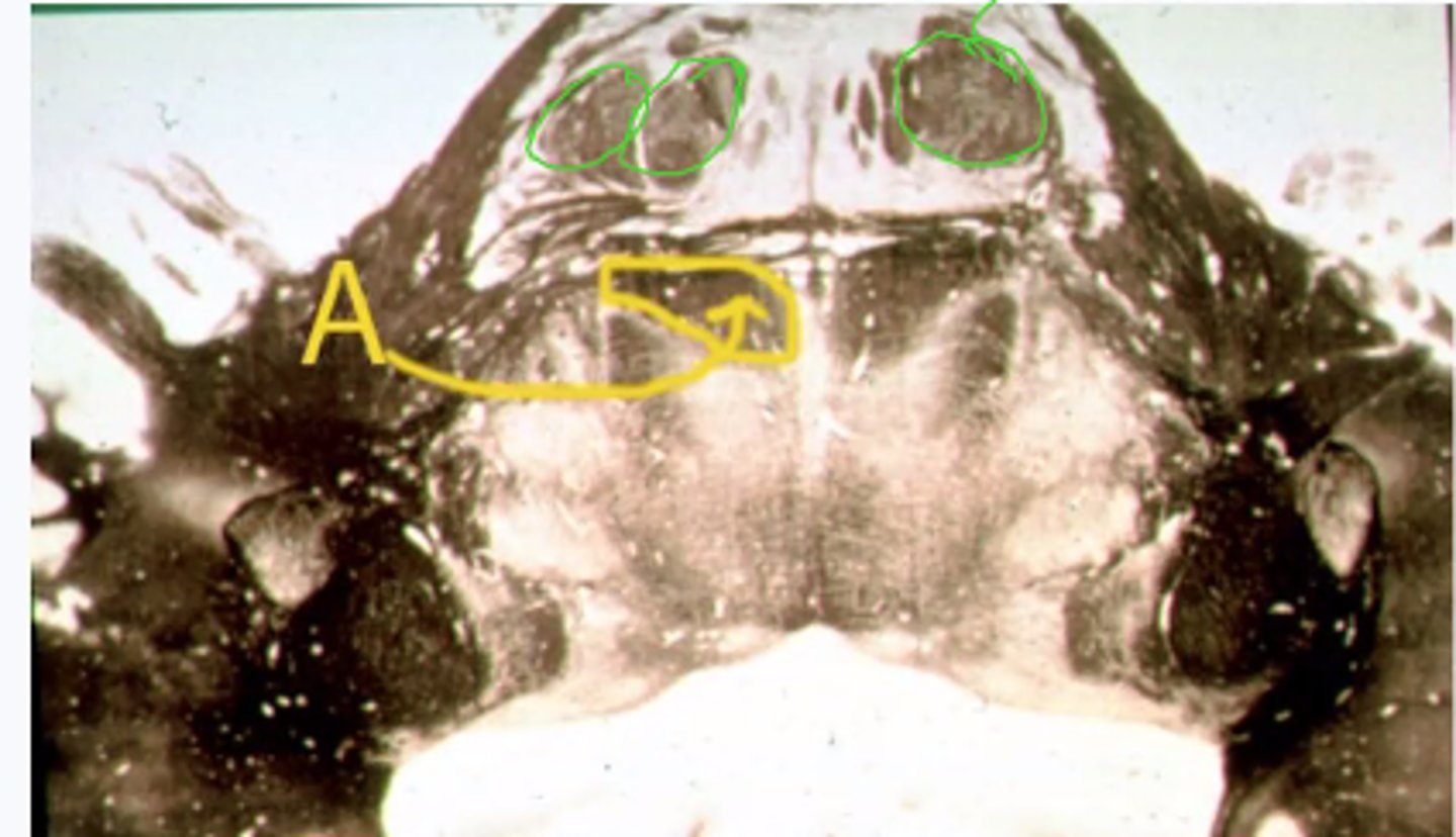 <p>Identify the structures indicated by the green outline</p>