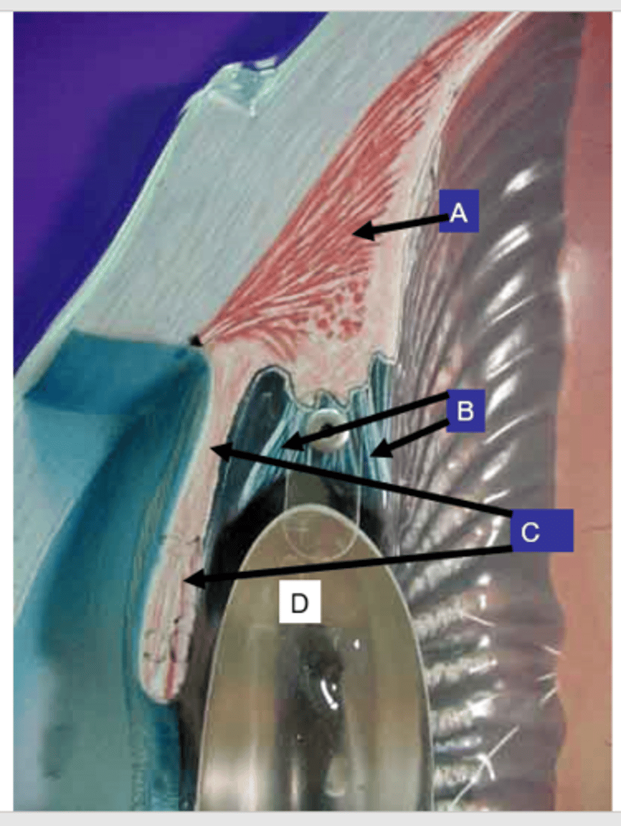 <p>What structure is the letter B?</p>