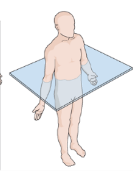 <p>What body plane is this?</p>