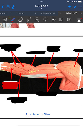 <p>What muscle is this?</p>