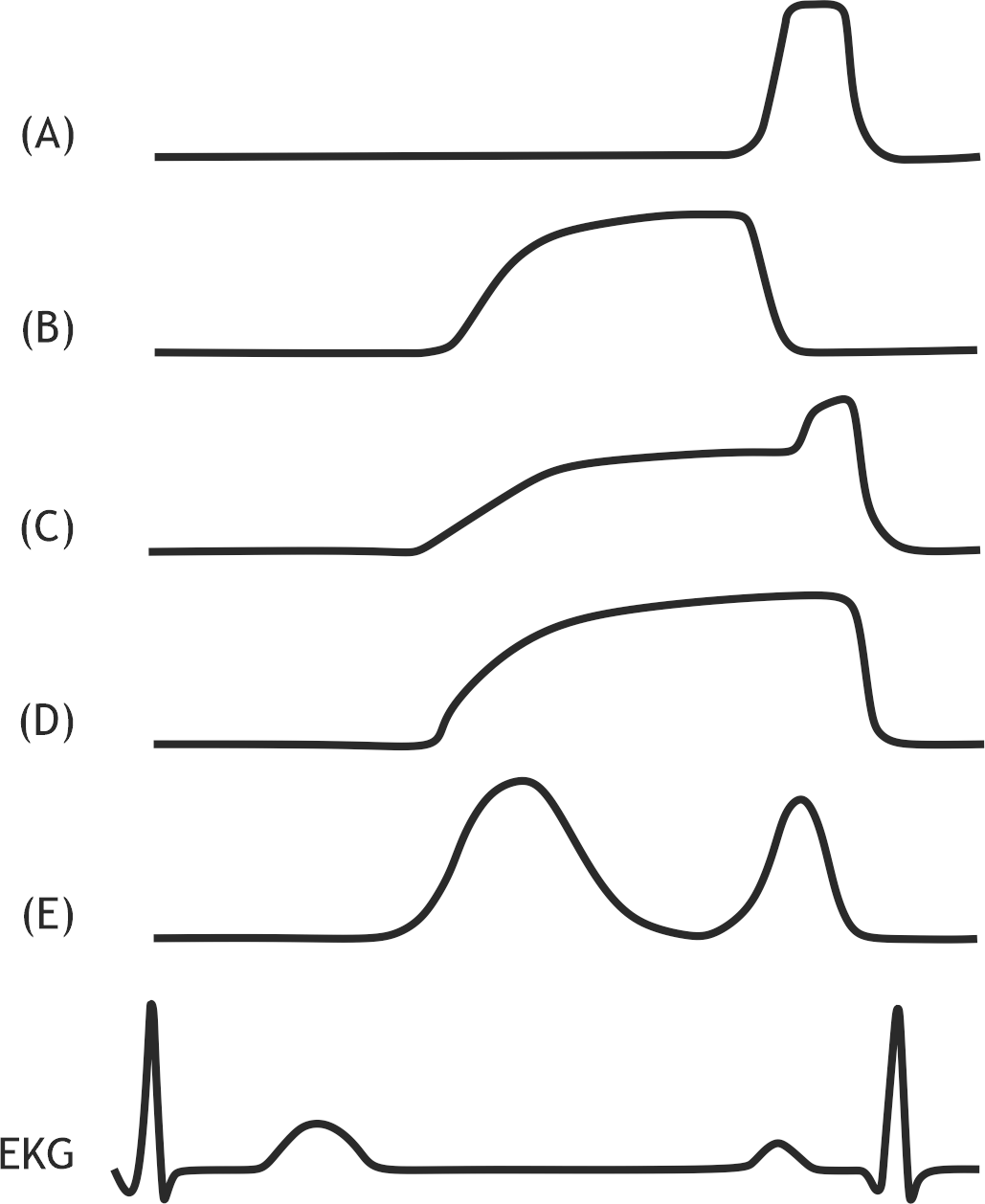 <p>35. The diastolic inflow velocity of volume into the left ventricle through the mitral valve changes during the cardiac cycle.</p><p>Which of the following curves most likely represents, under physiological conditions, the schematic course of the diastolic inflow velocity into the left ventricle?</p><p>A. (A)</p><p>B. (B)</p><p>C. (C)</p><p>D. (D)</p><p>E. (E)</p>