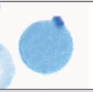 <p><strong>G6PD-deficiency, unstable hemoglobin disoders,</strong> oxidizing drugs/toxins, <strong>post-splenectomy</strong>&nbsp;</p>