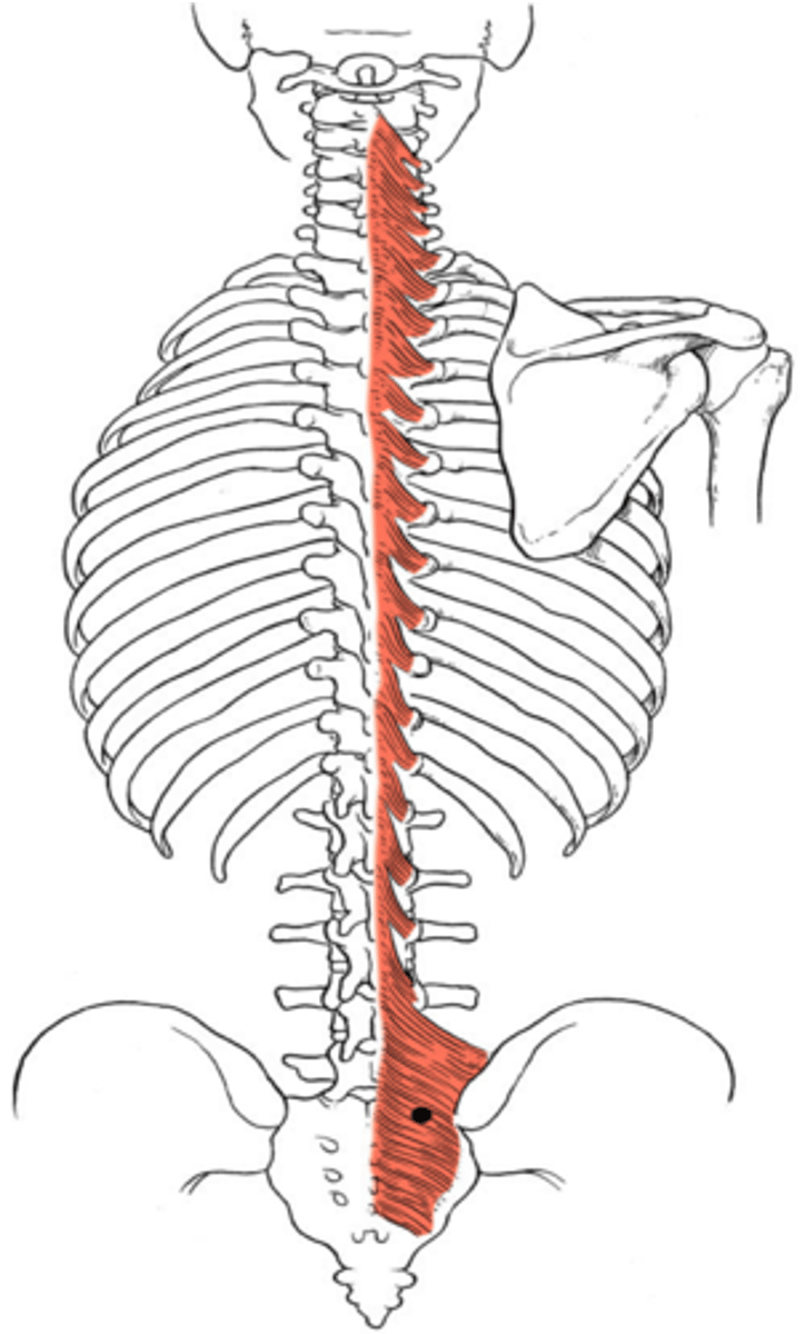 <p>Origin:</p><p>sacrum and transverse processes of each vertebra</p><p>Insertion:</p><p>spinous process of the 3rd or 4th more superior vertebra</p>