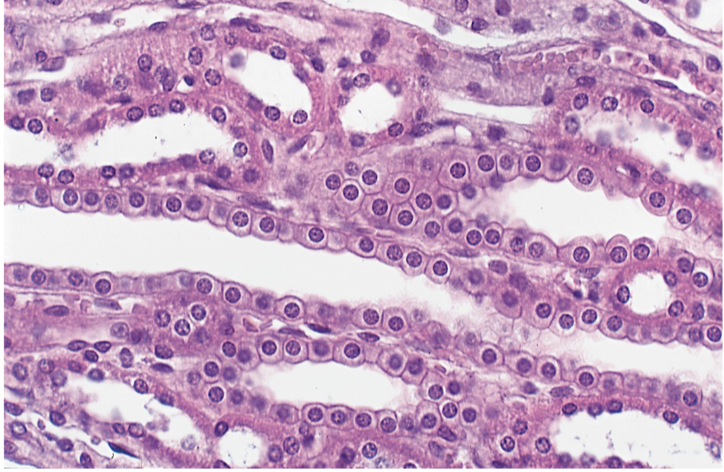 <p>Simple Cuboidal Epithelium</p>