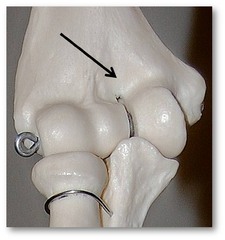 Name this specific part of the humerus.