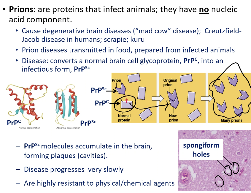 <ol type="1"><li><p><span style="font-family: &quot;ADLaM Display&quot;;"><span>The normal brain protein (PrP</span></span><span style="font-family: &quot;Times New Roman&quot;;"><span>ᶜ</span></span><span style="font-family: &quot;ADLaM Display&quot;;"><span>) is converted into an abnormal misfolded form (PrP</span></span><span style="font-family: &quot;Times New Roman&quot;;"><span>ˢᶜ</span></span><span style="font-family: &quot;ADLaM Display&quot;;"><span>)</span></span></p><ul><li><p><span style="font-family: &quot;ADLaM Display&quot;;"><span>Prp^sc binds to normal brain protein</span></span></p></li></ul></li></ol><p>&nbsp;</p><ol type="1"><li><p><span style="font-family: &quot;ADLaM Display&quot;;"><span>The abnormal proteins accumulate in the brain -&gt; forming plaques and cavities</span></span></p></li></ol><p>&nbsp;</p><ol type="1"><li><p><span style="font-family: &quot;ADLaM Display&quot;;"><span>The brain tissue becomes spongy</span></span></p></li></ol><p>&nbsp;</p><ol type="1"><li><p><span style="font-family: &quot;ADLaM Display&quot;;"><span>Disease progresses very slowly but is always fatal</span></span></p></li></ol><p></p>