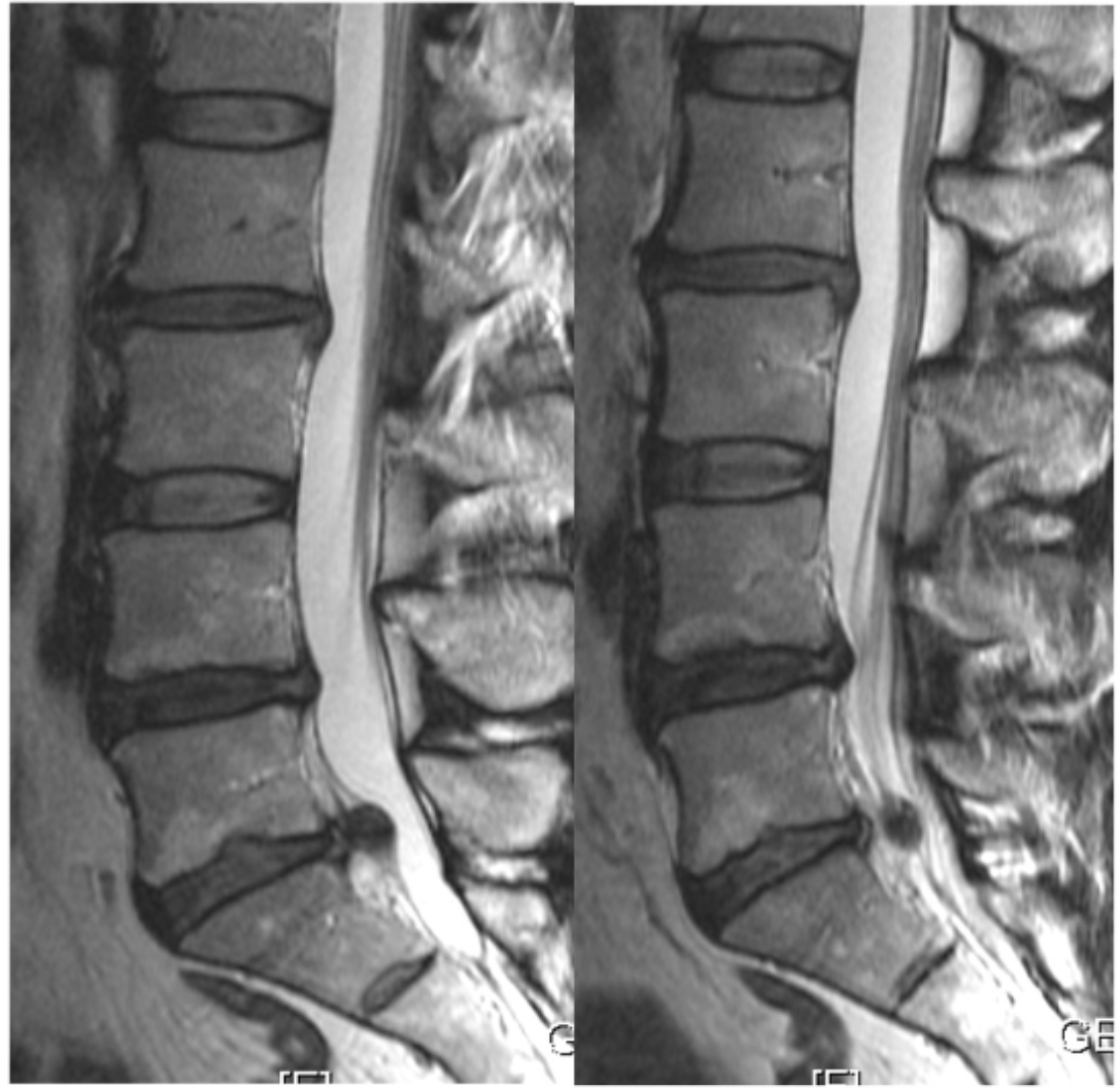 <p>Name the pathology. </p>