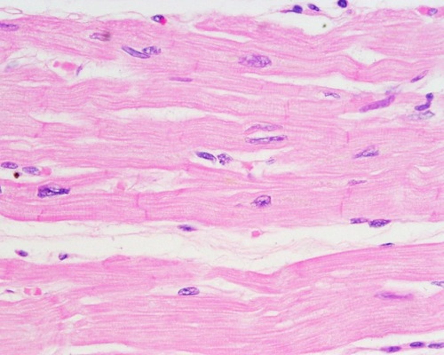 <p>Cardiac muscle is striated, involuntary, and the fibers are attached by intercalated discs.</p>