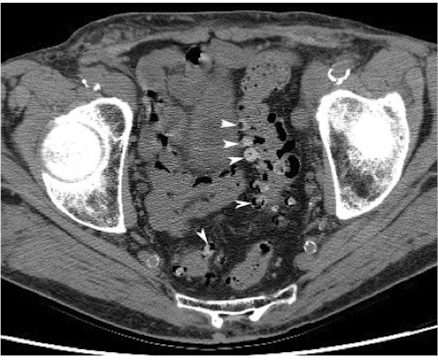 <p>What is this and what type of scan </p>