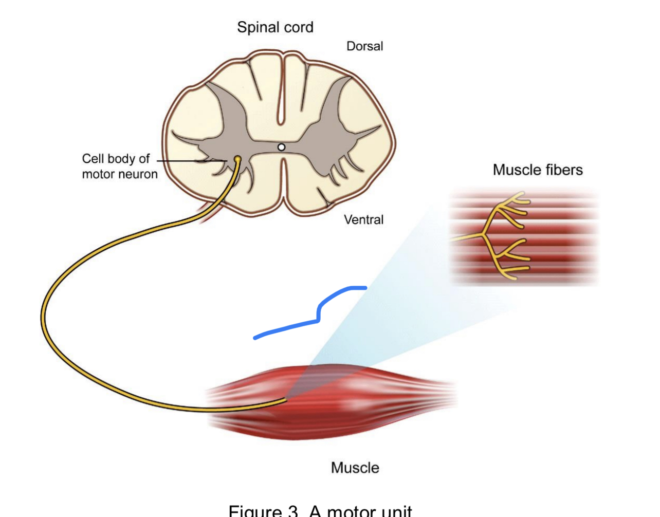 a single motor neuron and the muscle fibers it innervated